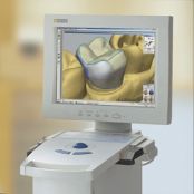 cerec2.jpg